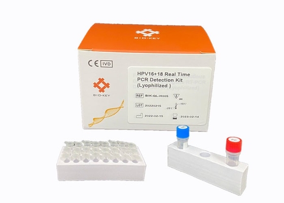 Πραγματικός - χρονικό HPV PCR δοκιμή ελέγχων Taqman ιών Genotyping HPV υψηλού κινδύνου Dectect εξαρτήσεων